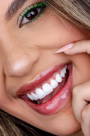 Imagen de Blanqueamiento dental